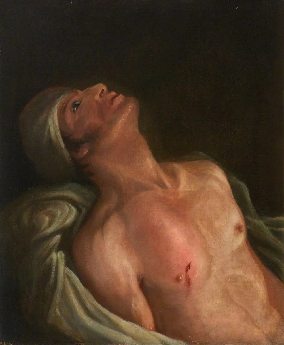 The Wounded following the Battle of Corunna: Gunshot Wound of Scapula — Charles Bell